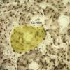 osteon